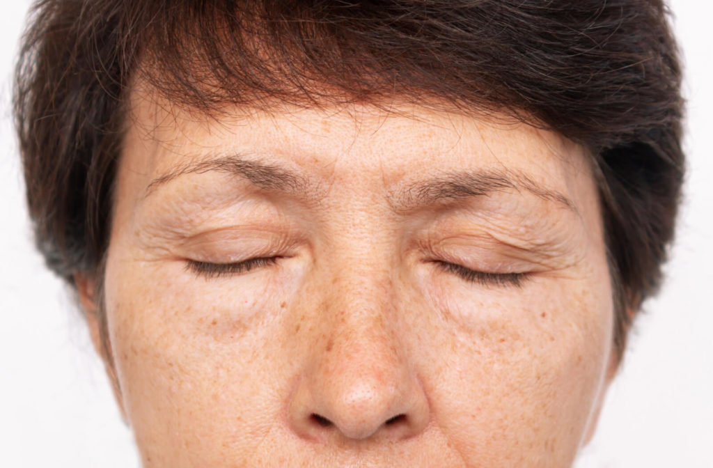 A close-up of an elderly woman closing her eyes to refocus her eyesight because she is seeing floaters.  The most common cause of eye flashes and floaters is age-related and considered normal and does not usually require any treatment.