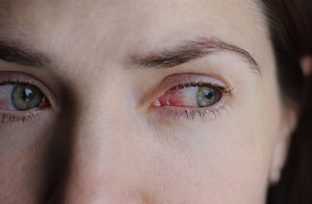 A close-up of a woman with red eyes.