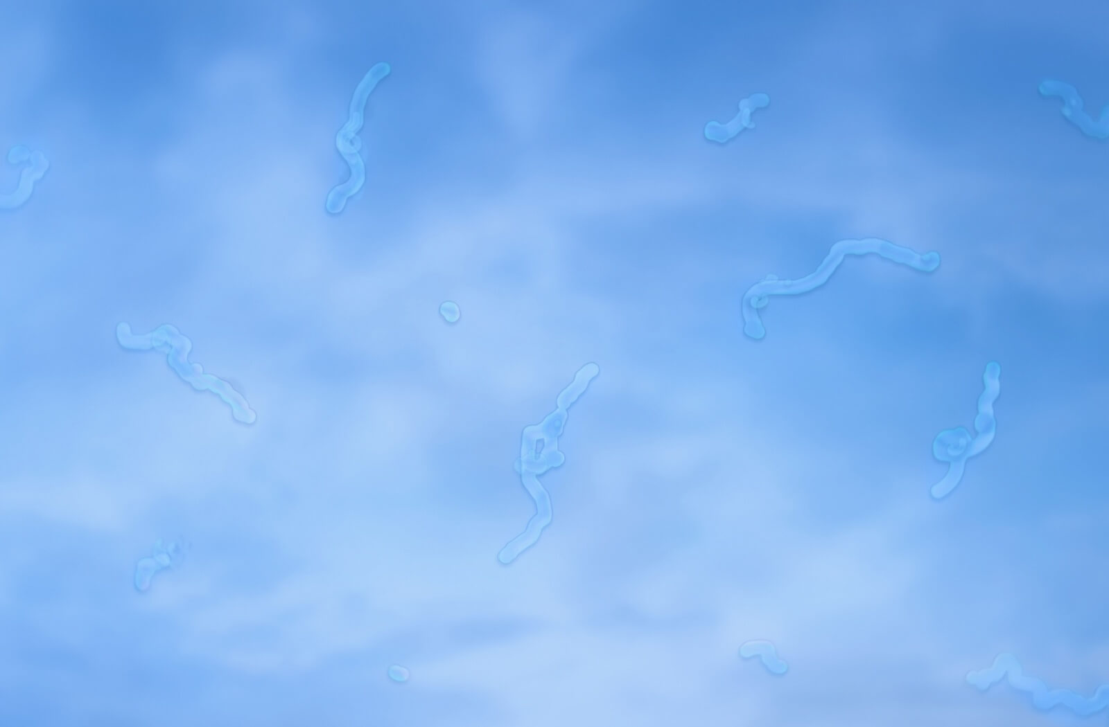 A view of a blue sky with many squiggly lines to show what floaters look like.
