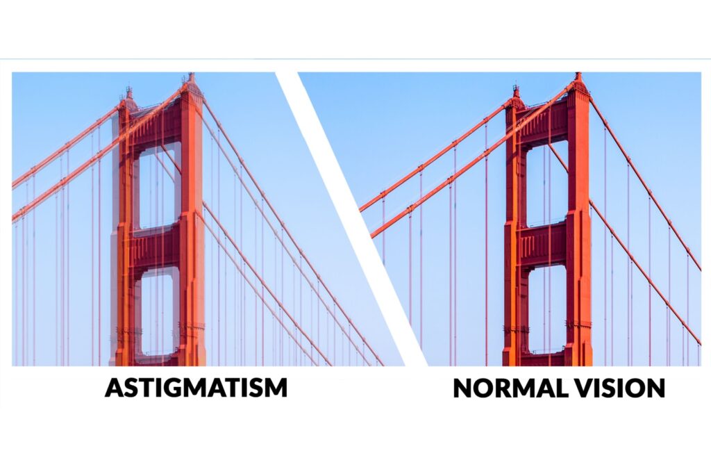 Side-by-side comparison showing how astigmatism distorts vision versus normal clear vision.